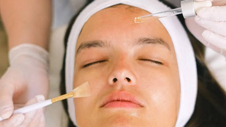 Chemical Peel for Sun Damage: Why Fall Is the Smart Time to Start